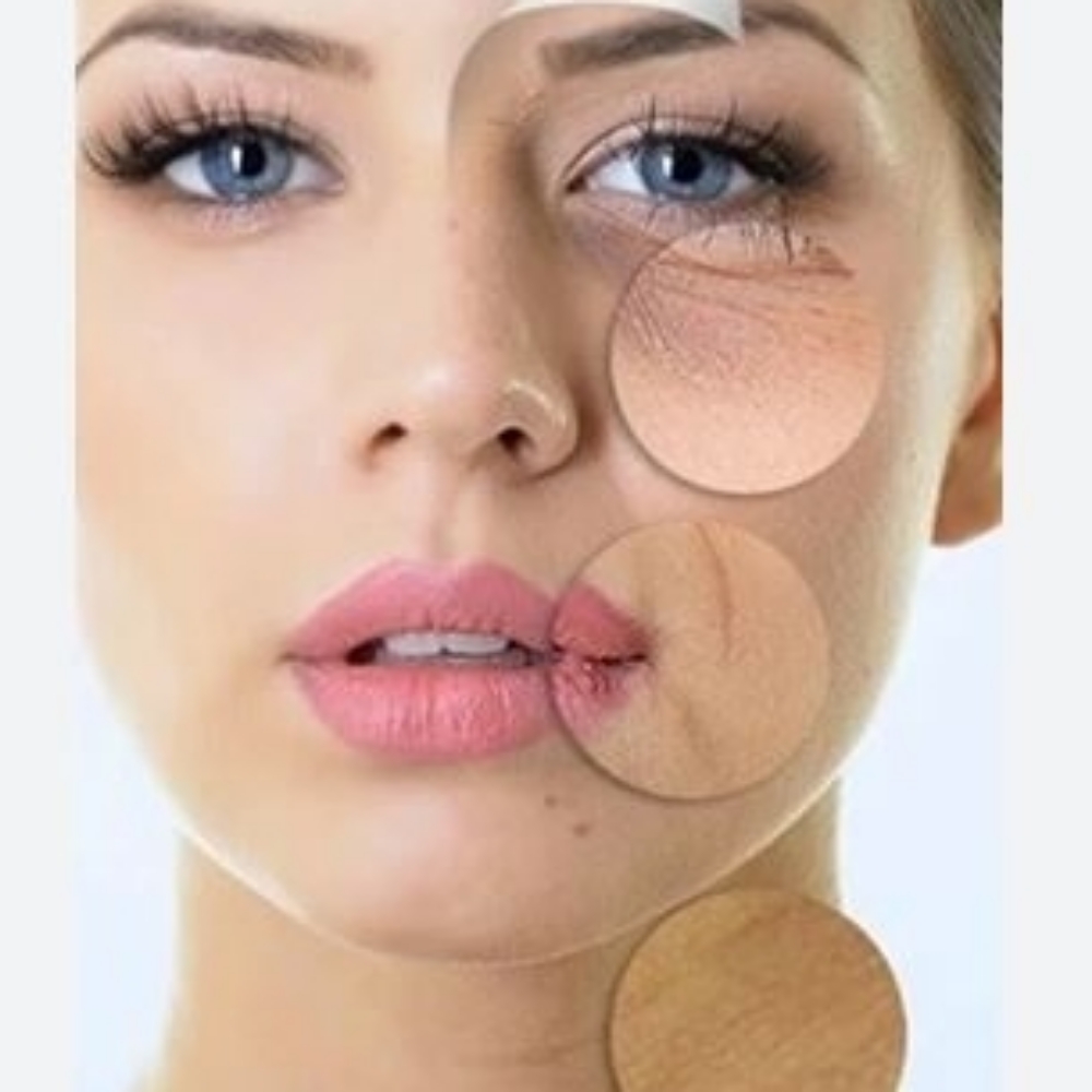 Advanced Renewal Peel at Facial Sensations in Lewisville, TX