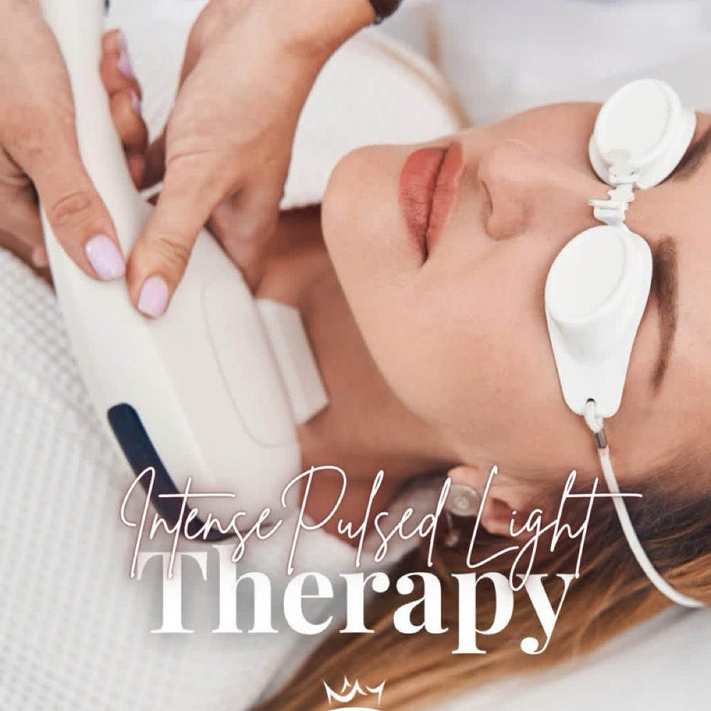 IPL at ARock Beauty & Wellness in San Angelo, TX