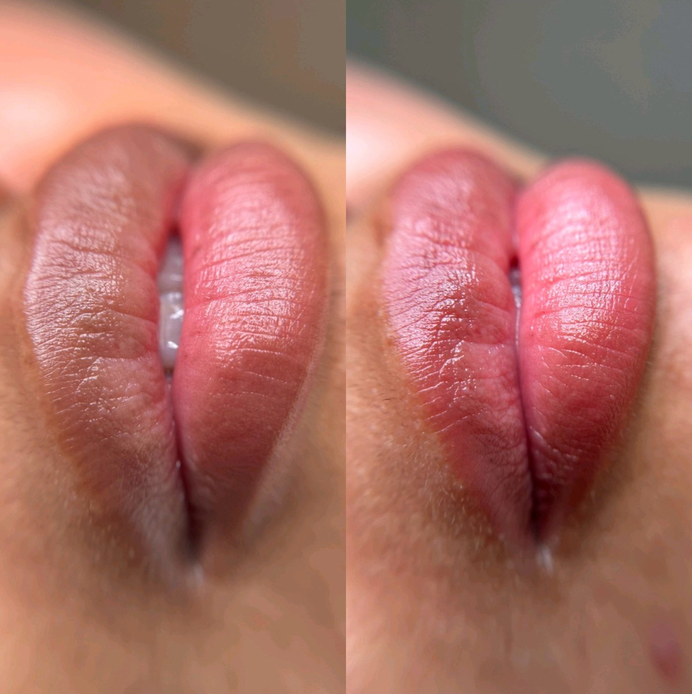 Lip Neutralization