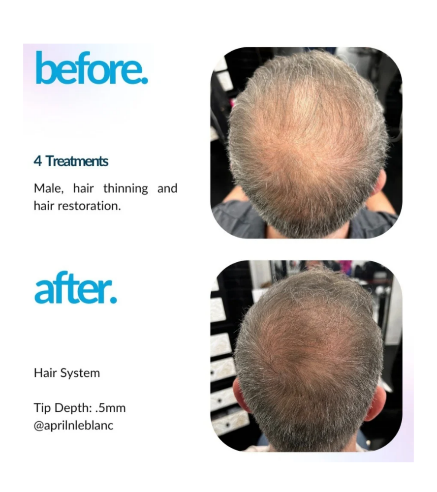 Envy Hair Regrow Treatment