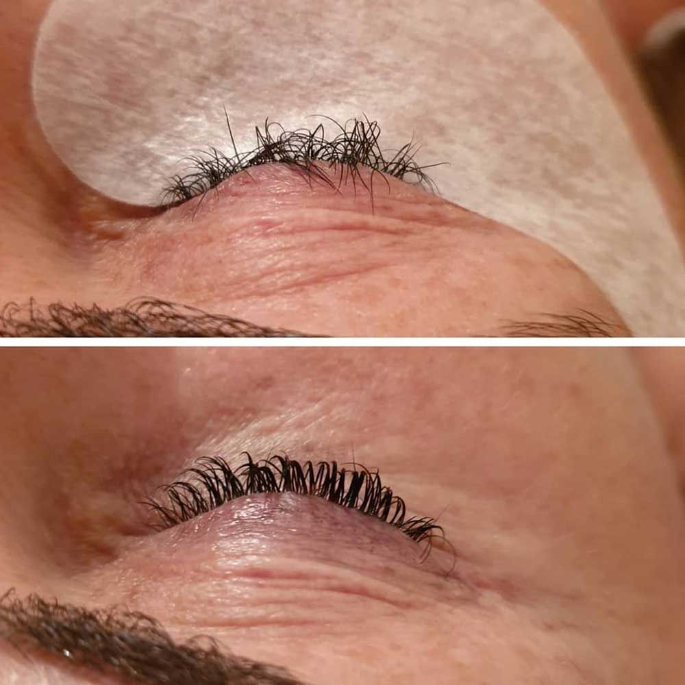 Reverse Lash Lift