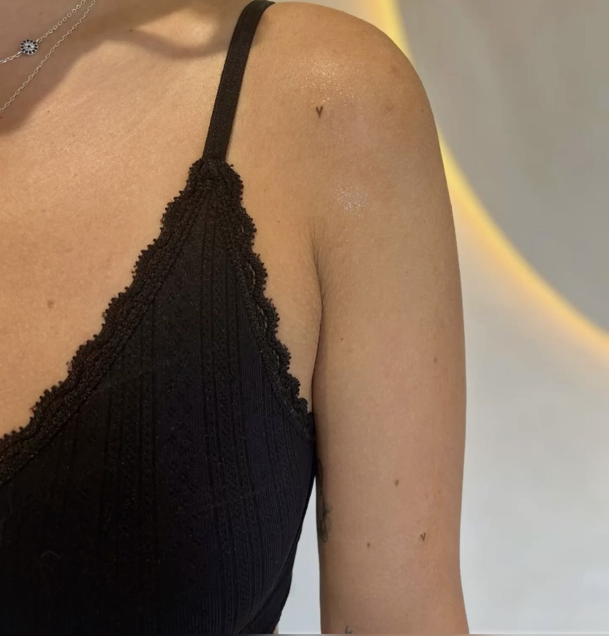 Freckles: Beyond the Face at Fallen Angel Tattoo in Portland, OR