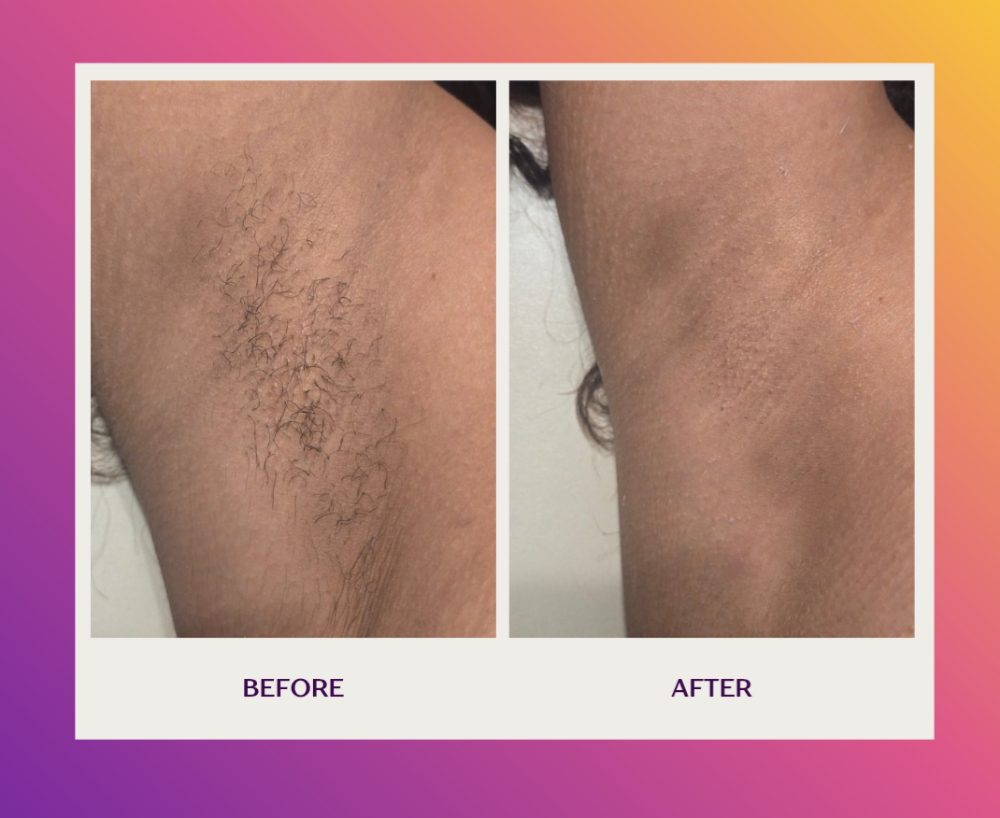 Underarm Wax