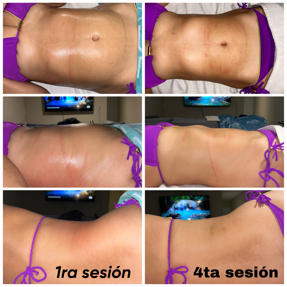 Woodtherapy at Ungüento Massage Therapy in Killeen, TX