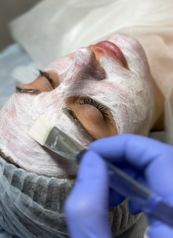 Acne Rescue Facial