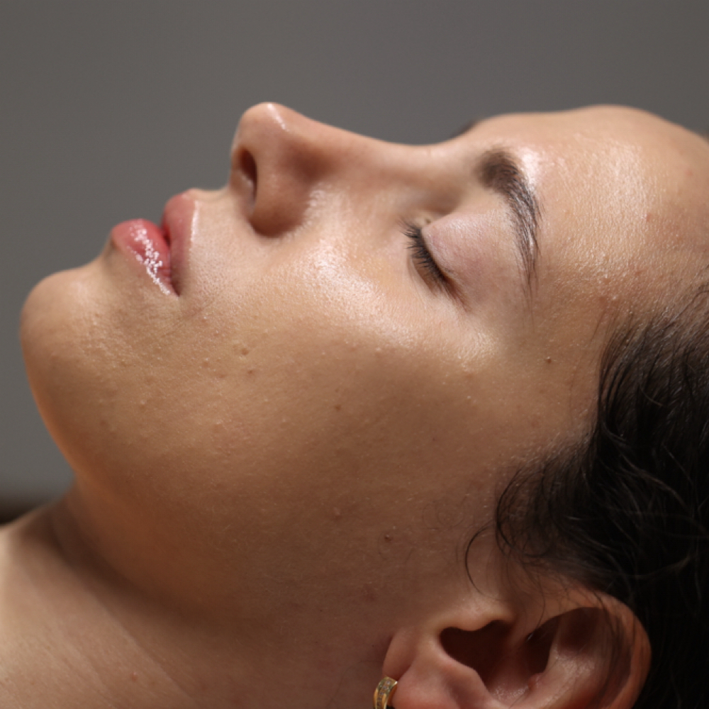 The Lymph Reset at Floetouch in San Diego, CA