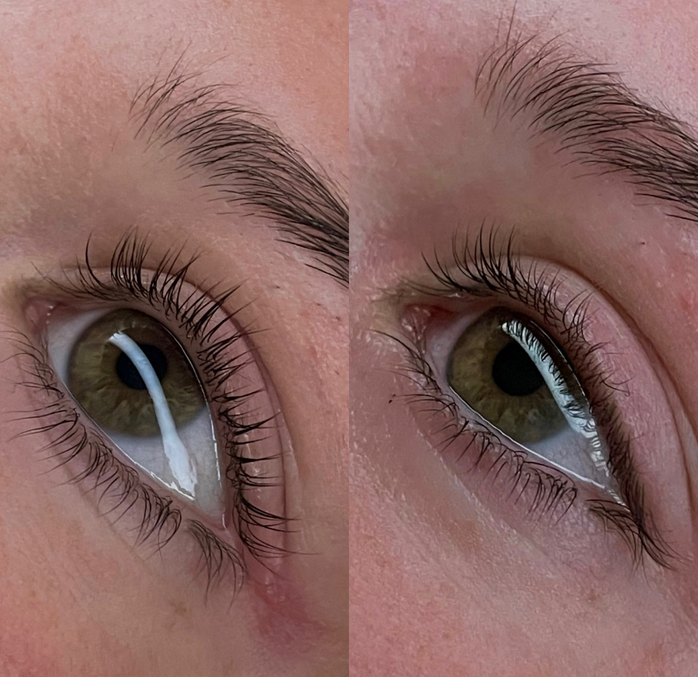 Lash Lift