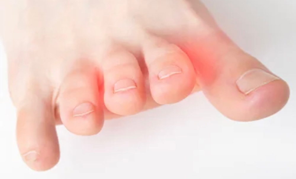 Toes Gel Removal Or Soak Off