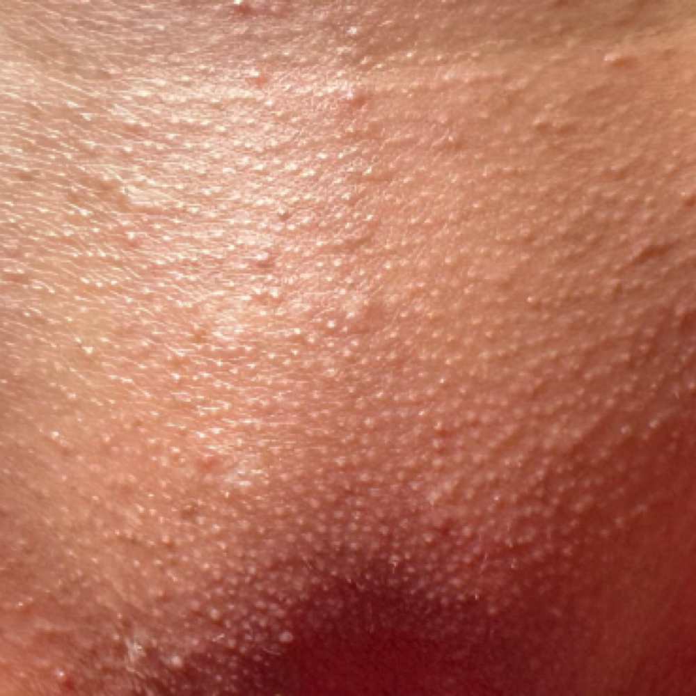 Vajacial at A1 Aesthetics LLC in Hudson, NY