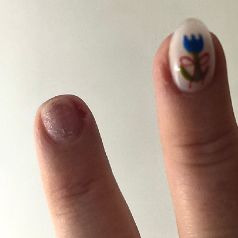 Broken Nail Fix (2 Weeks Or Less) at Ladyfinger in Christiansburg, VA