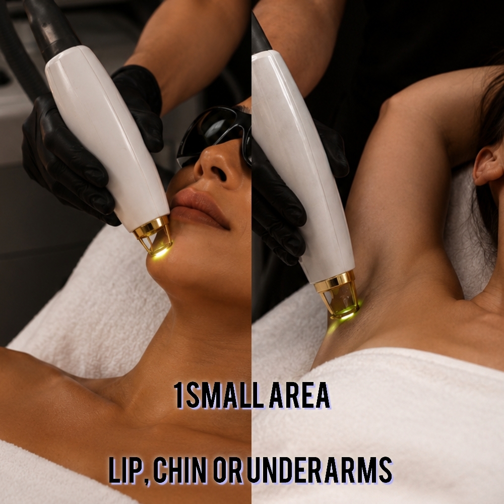 Pre PAID laser 1 Small Area at Day 2 Skin LLC in Fort Oglethorpe, GA