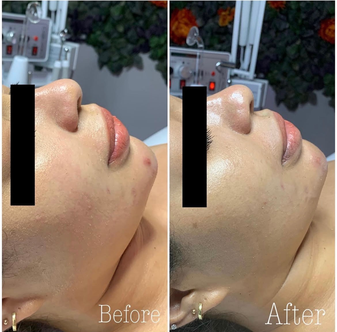 Soothing Facial