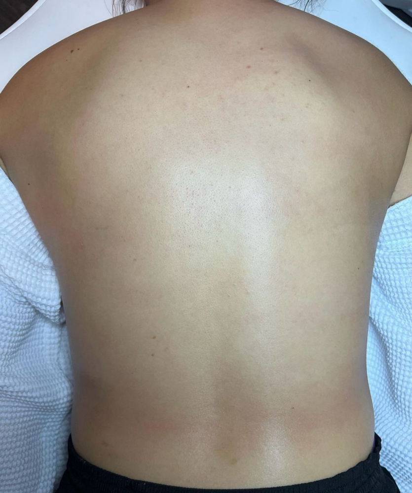 Back Wax (Full)