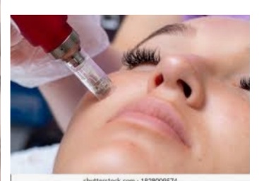 CIT Nano/micro Needling