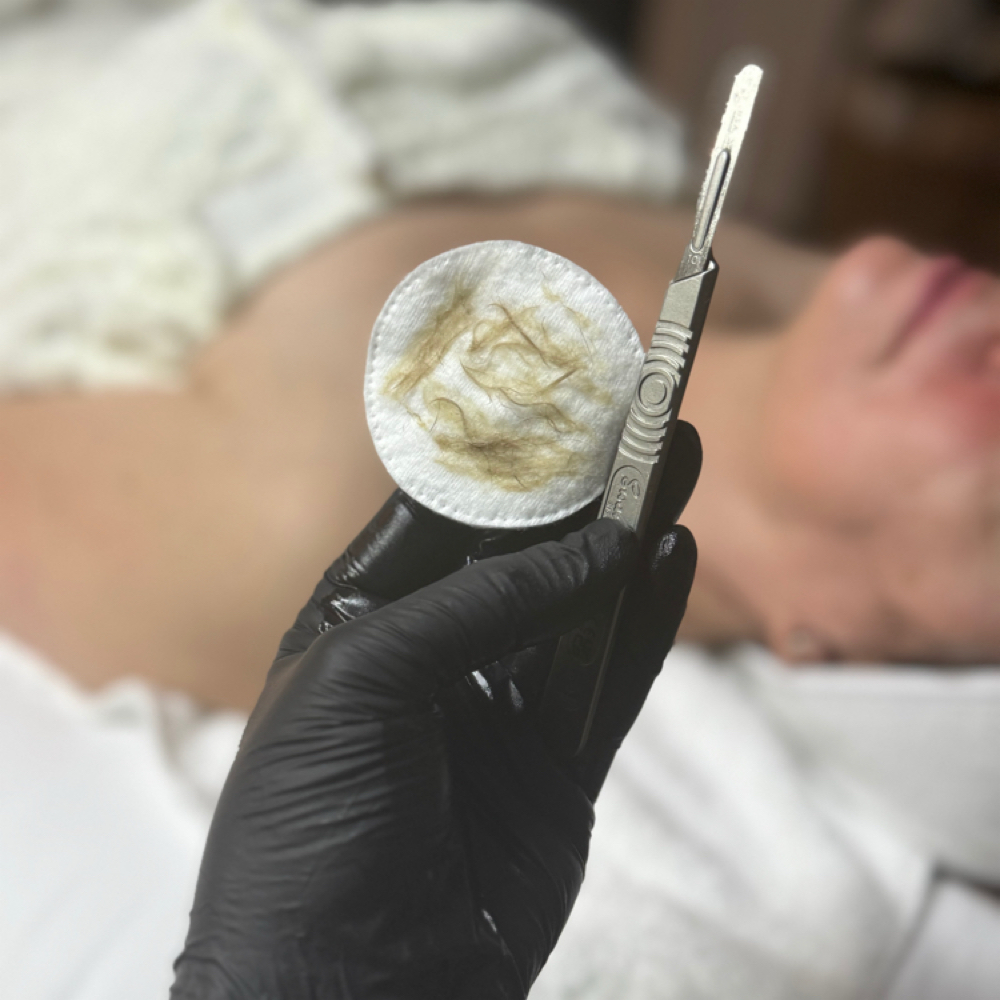 Dermaplaning + Customised Facial at Solura Beauty & Wellness in Deland, FL