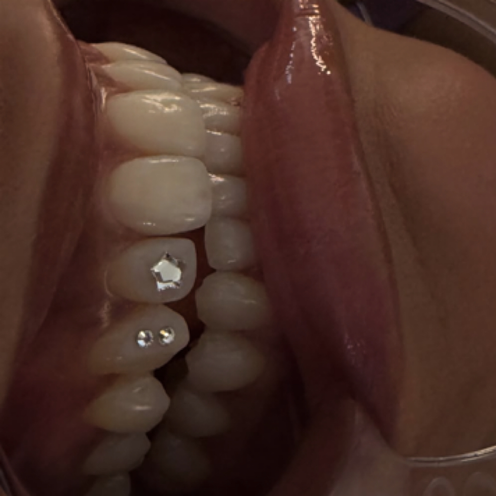 Tooth Gems at Get AT me Beauty in Chula Vista, CA