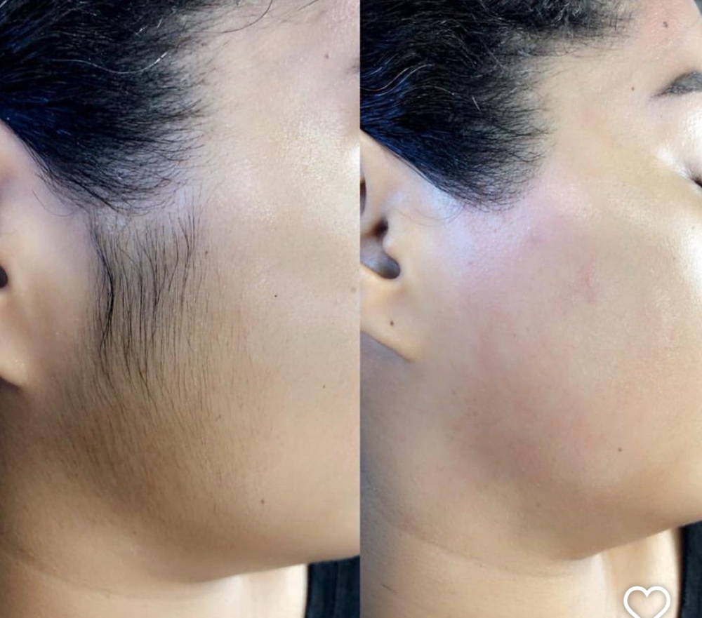 Side Burns Wax at Unveiled skin in Moreno Valley, CA