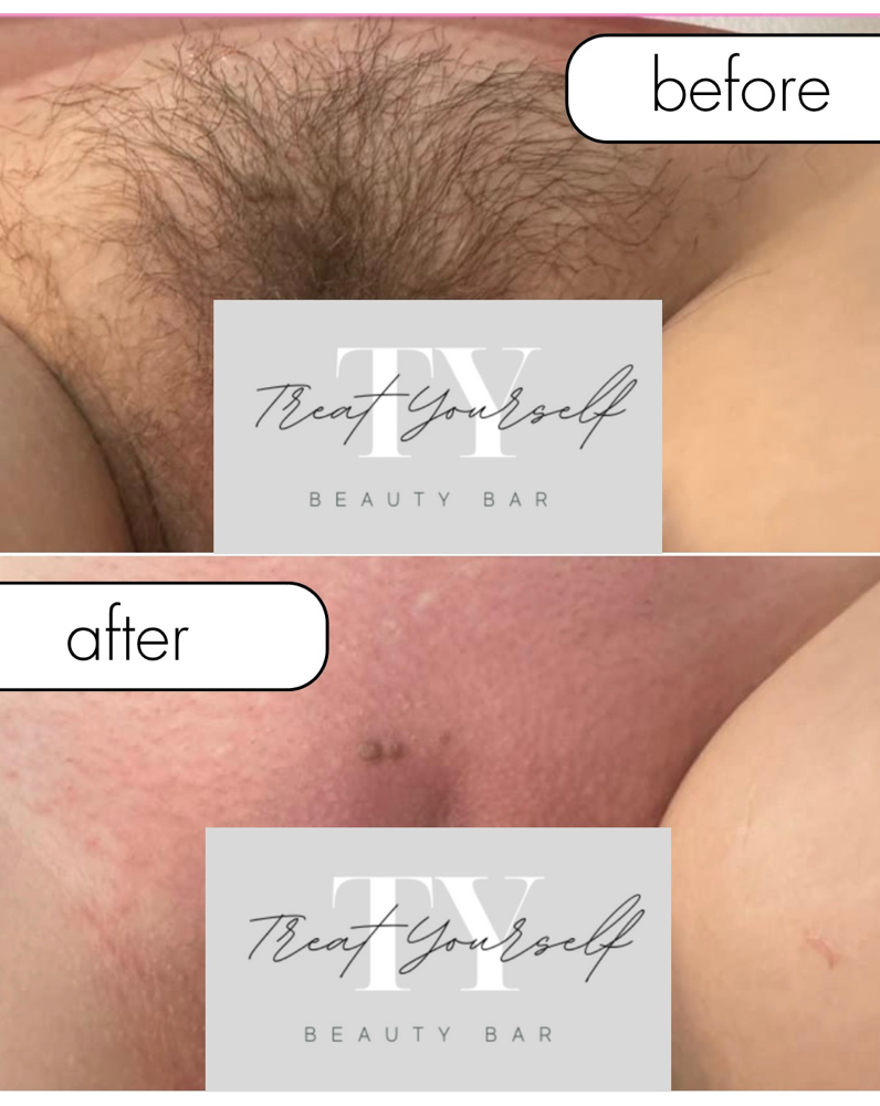 Ending February Brazilian Wax