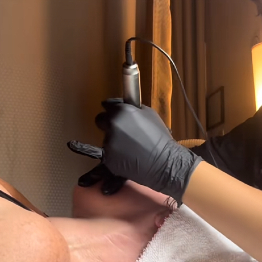 Microneedling at Queensmade Esthetics in Wilmington, NC