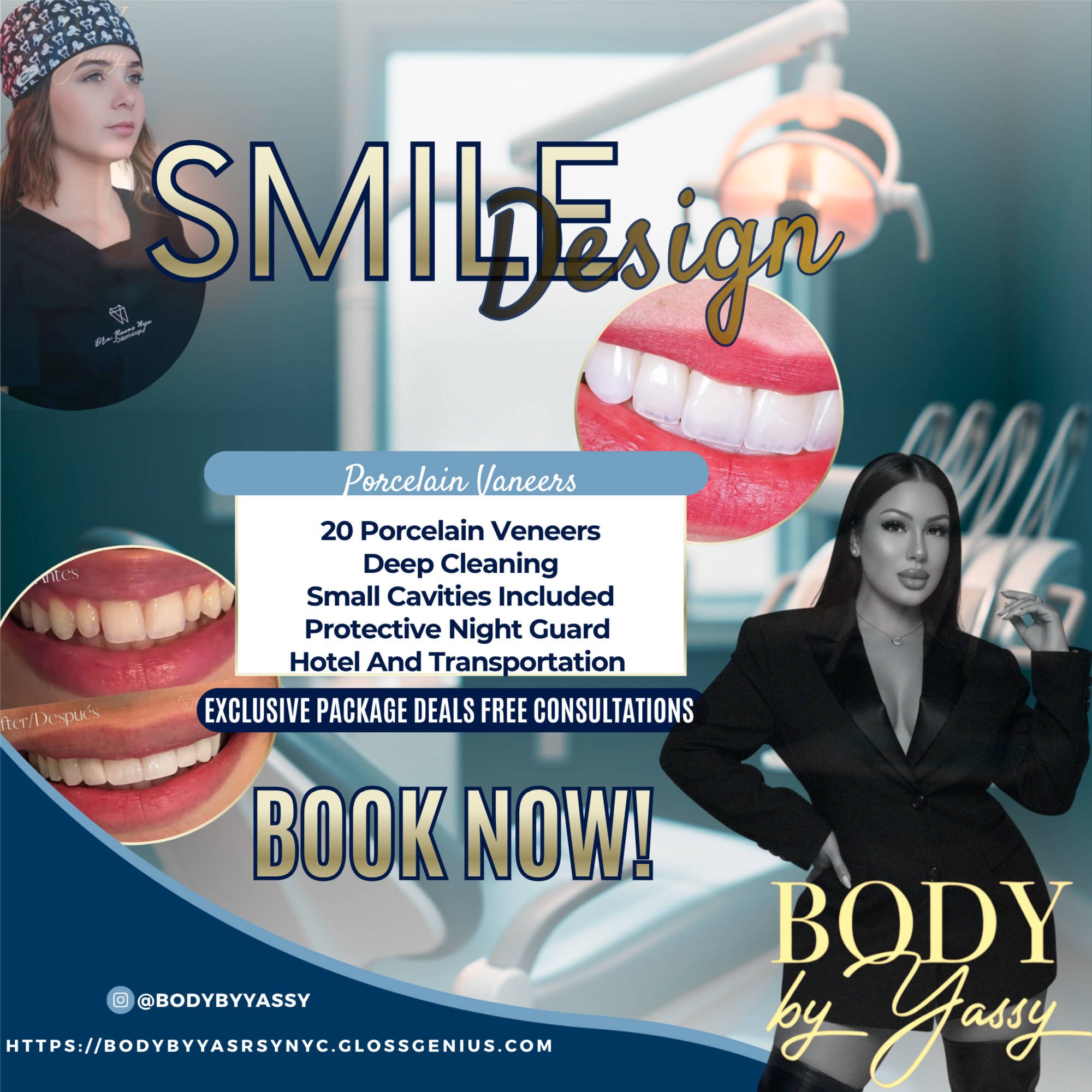 20 Porcelain Veneers