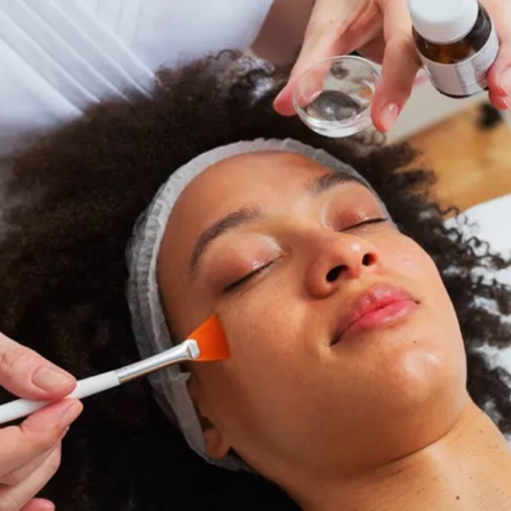 Chemical Peel With Facial at Fresh Face Spa in San Diego, CA