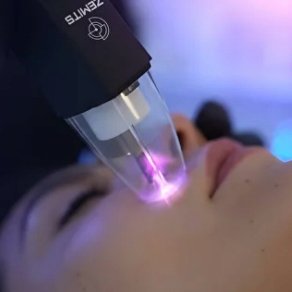 Upgrade: EVO-Cold Plasma Treatment