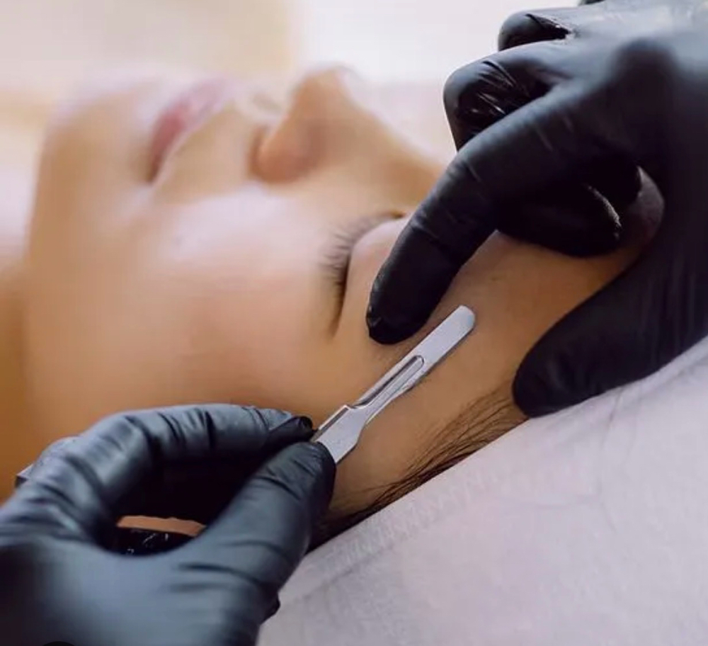 Dermaplaning Add-On at Earth & Aura Esthetics LLC in Oakland, MD