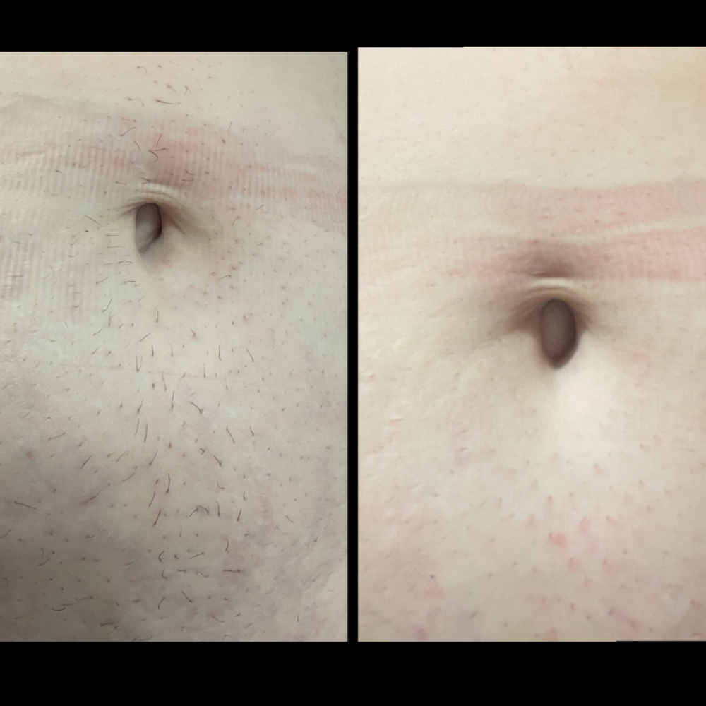 Stomach Wax at Mad Threading in Rockford, IL