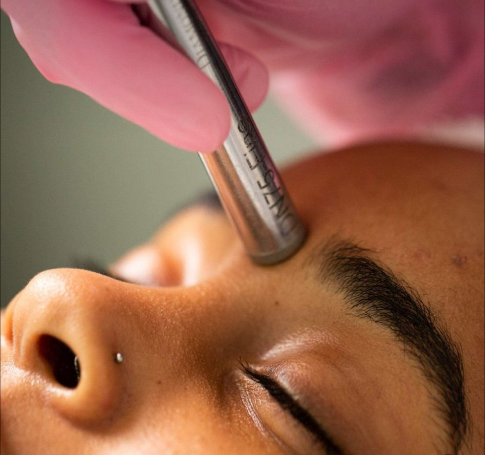 Facials - Microdermabrasion