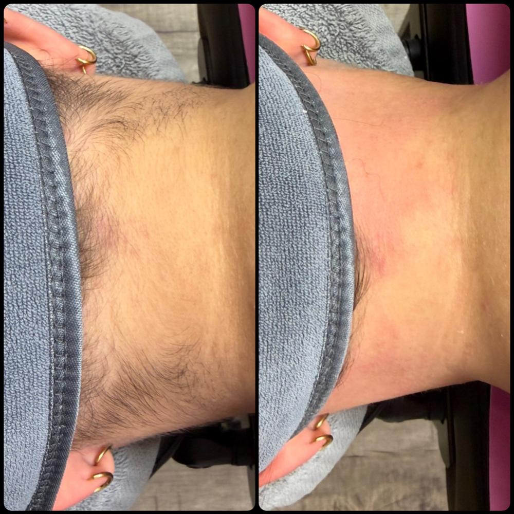 Hairline Wax at Artistry by Abby in Clio, MI