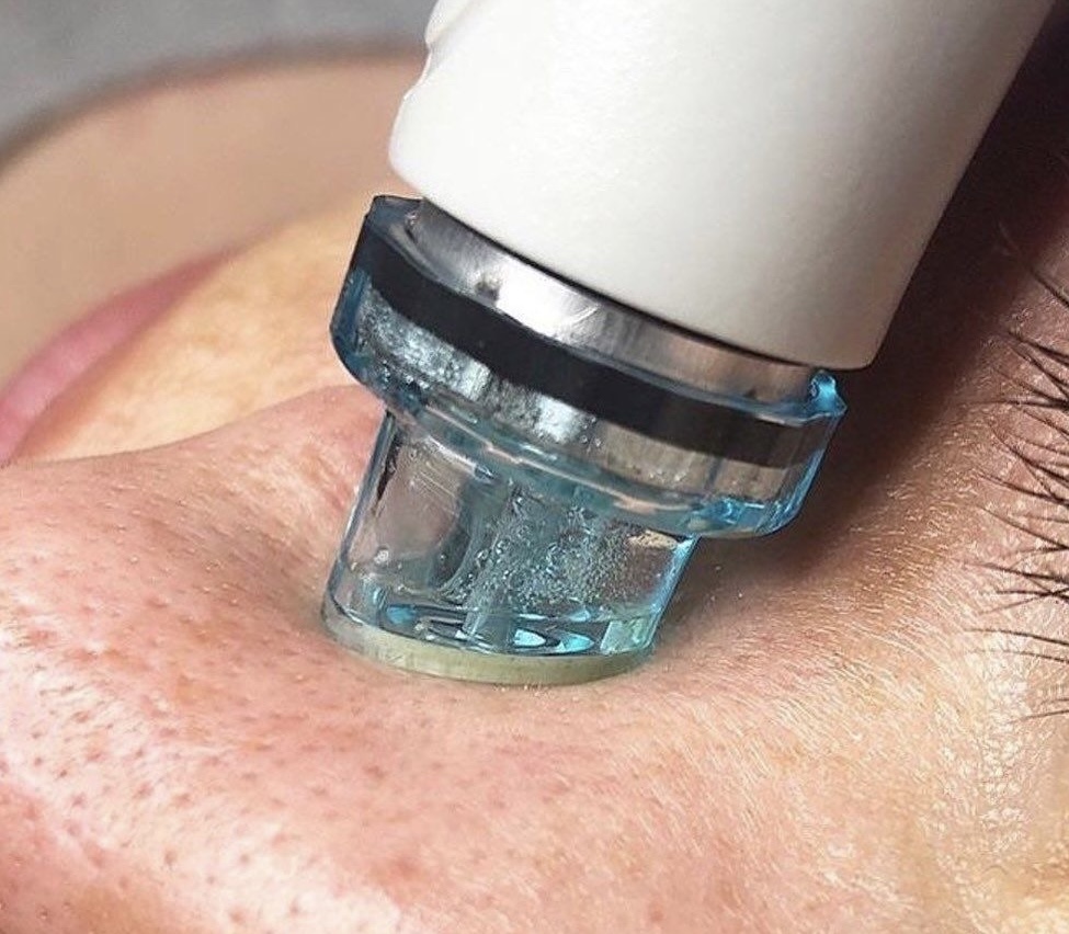 HydroGlow Facial at Glow + Grace in West Monroe, LA