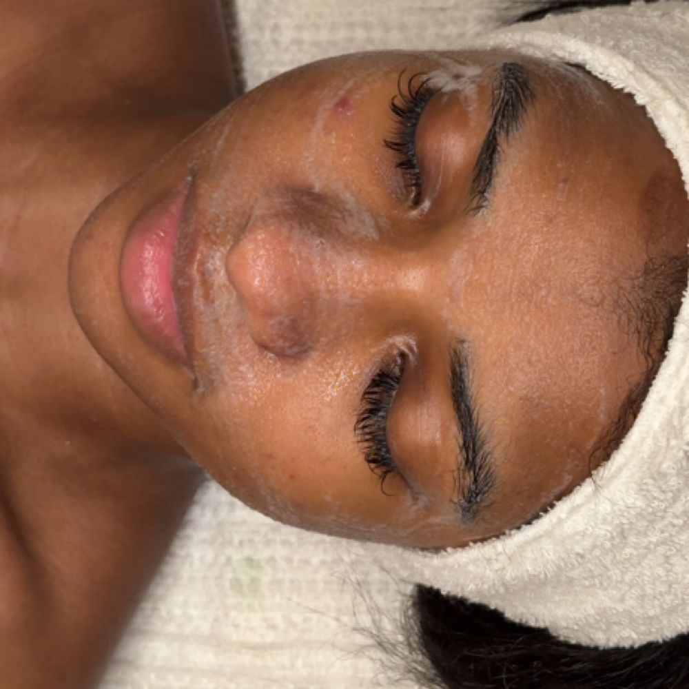 Clear Skin Bootcamp Consult + Peel at 3eleven Skin in Las Vegas, NV