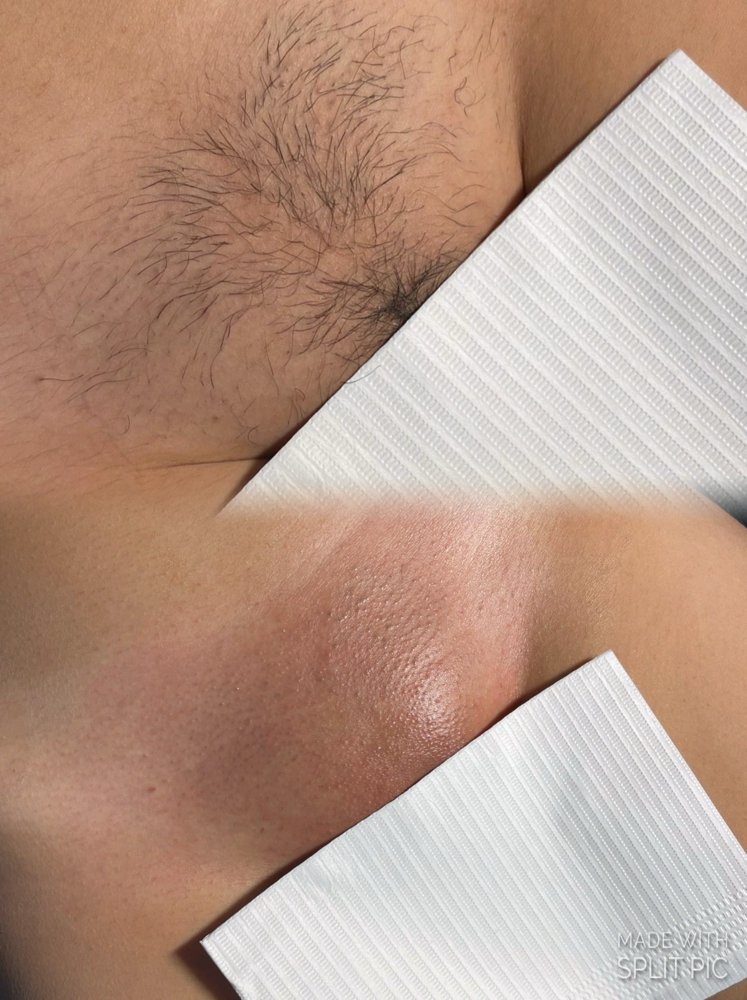 Bikini Wax