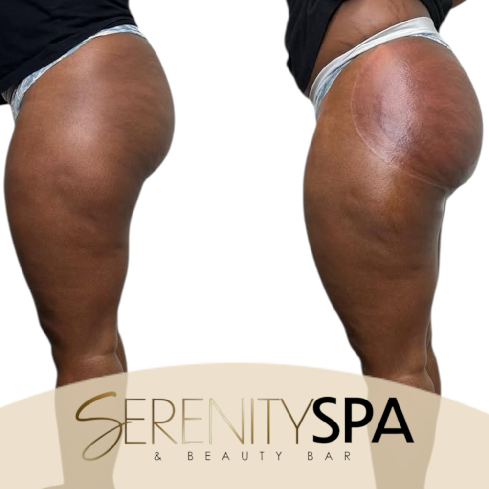 Mini Vacuum Therapy Session at Serenity Spa & Beauty Bar in Warwick, RI