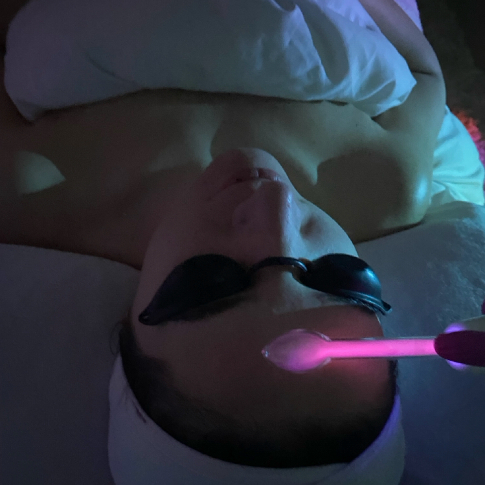 Acne Treatment (Existing Clients) at skin by gianna v in yorktown, NY
