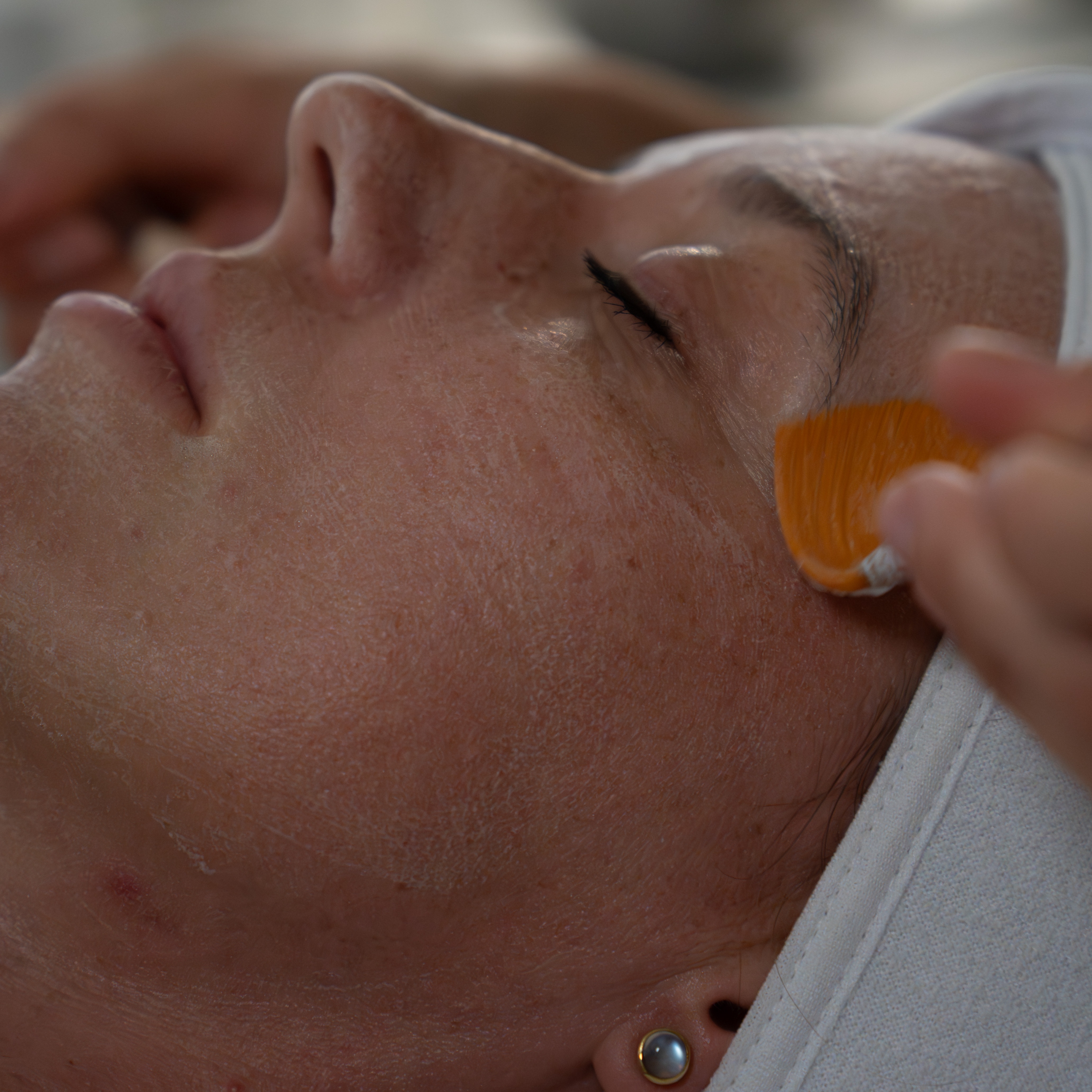 Add-On Chem. Peel | Simildiet Spain