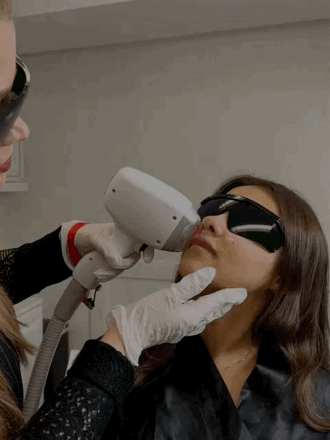 Laser Buço/Lip