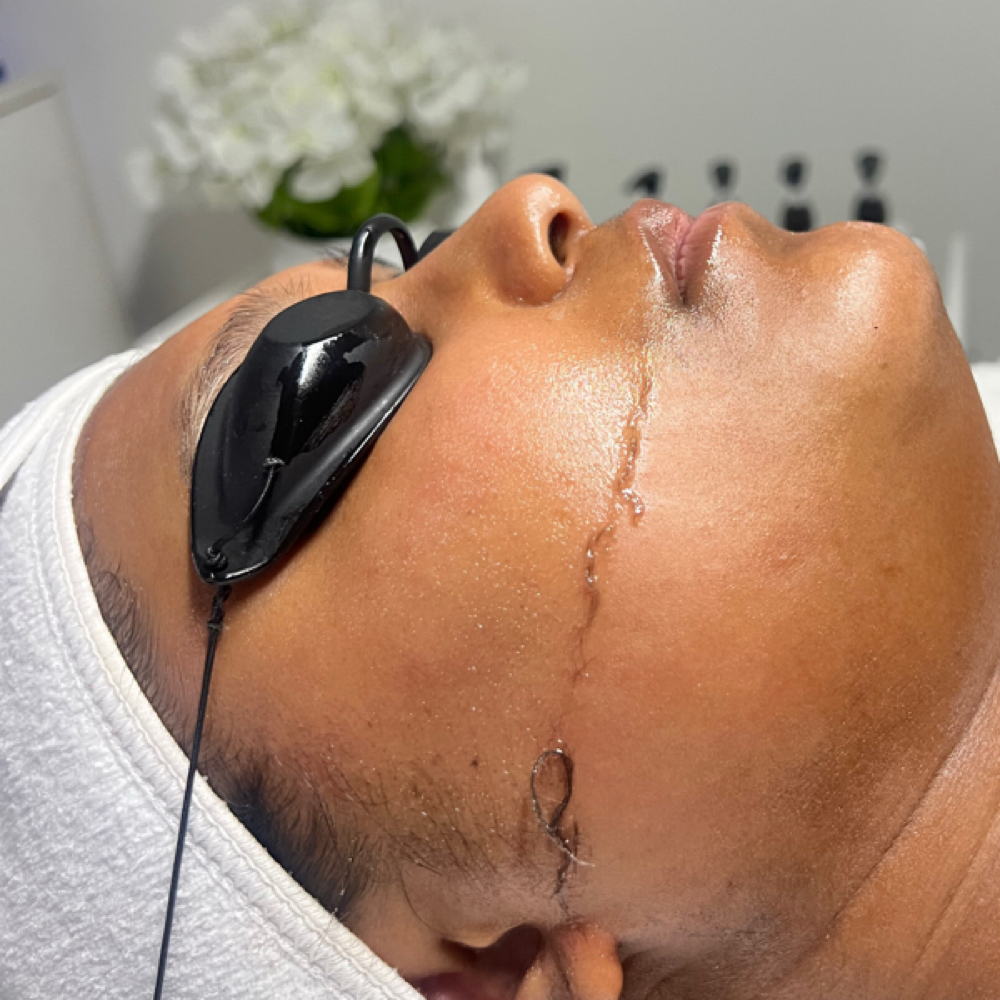 Dermaplanning ADD ON at Sweet Touch Skin in Manassas, VA