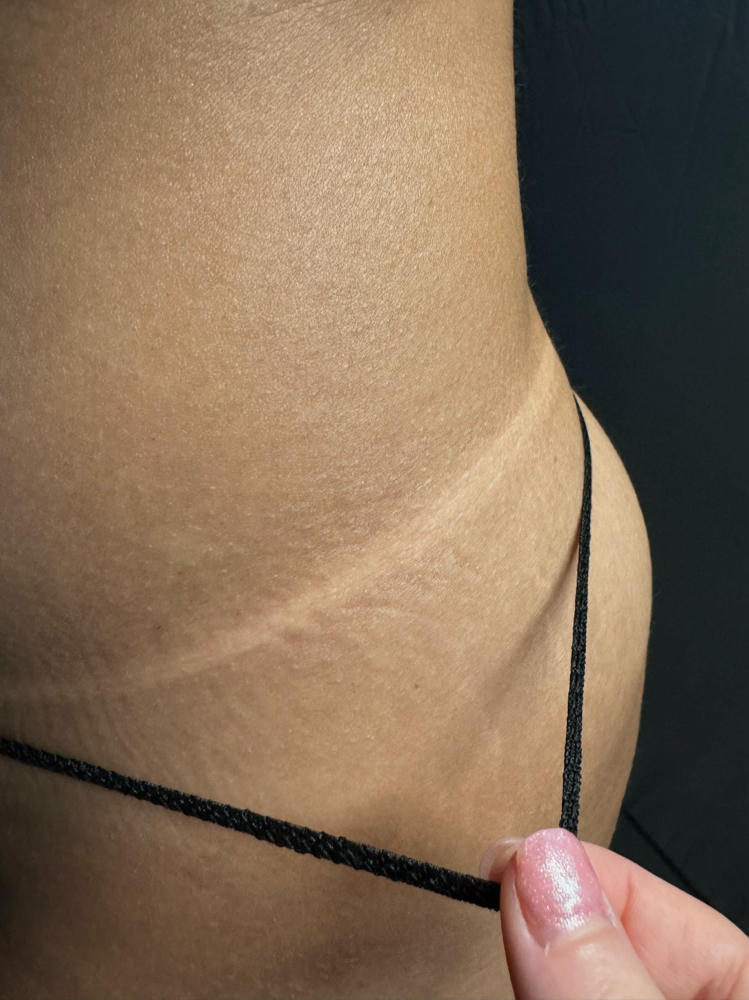 Spray Tan