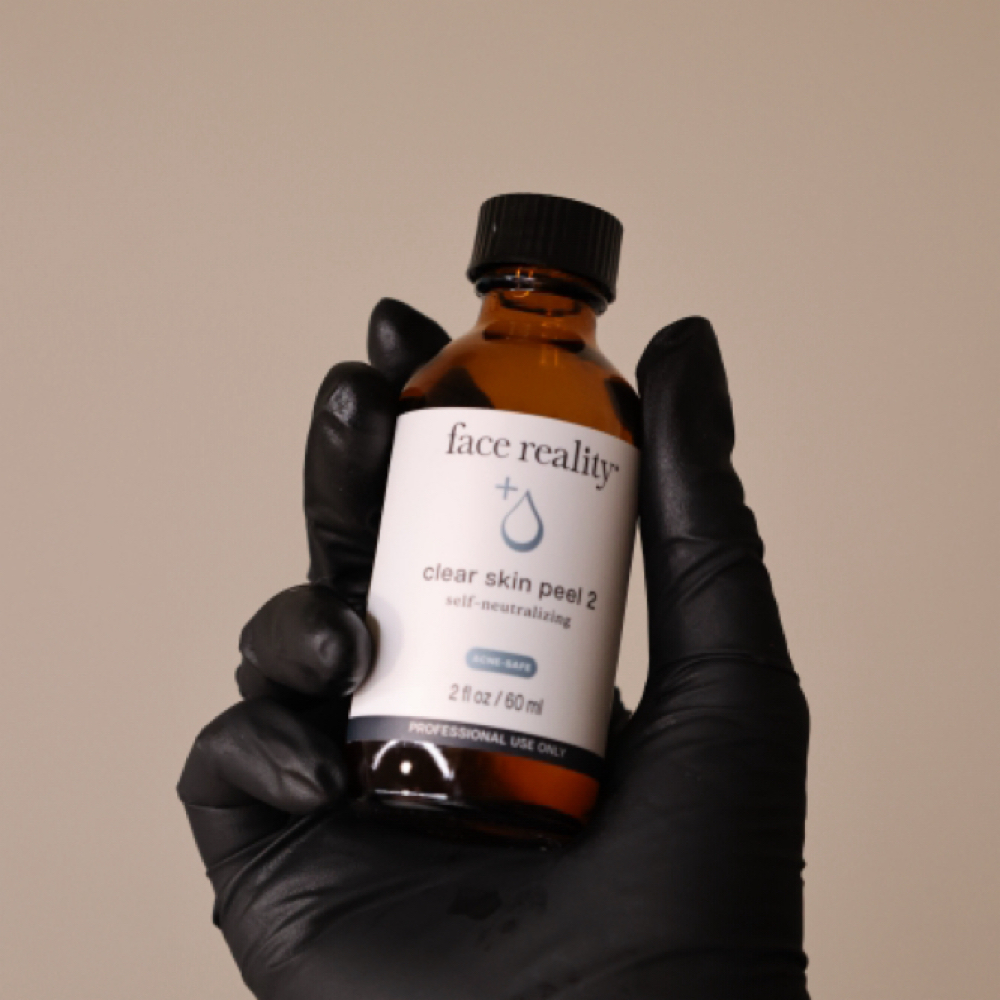 Back Clarity Peel at SORA Skin & Ritual House in Peoria, AZ