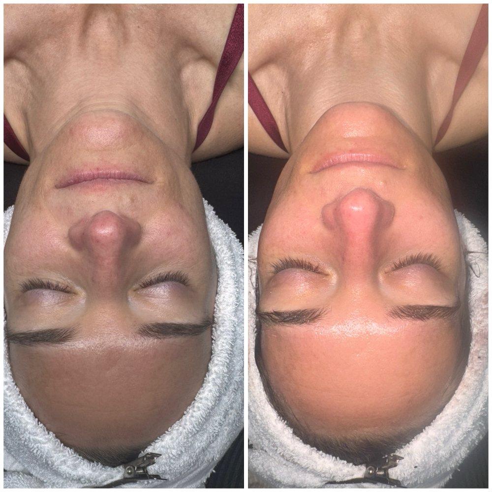 Fall Facial -OCTOBER SPECIAL