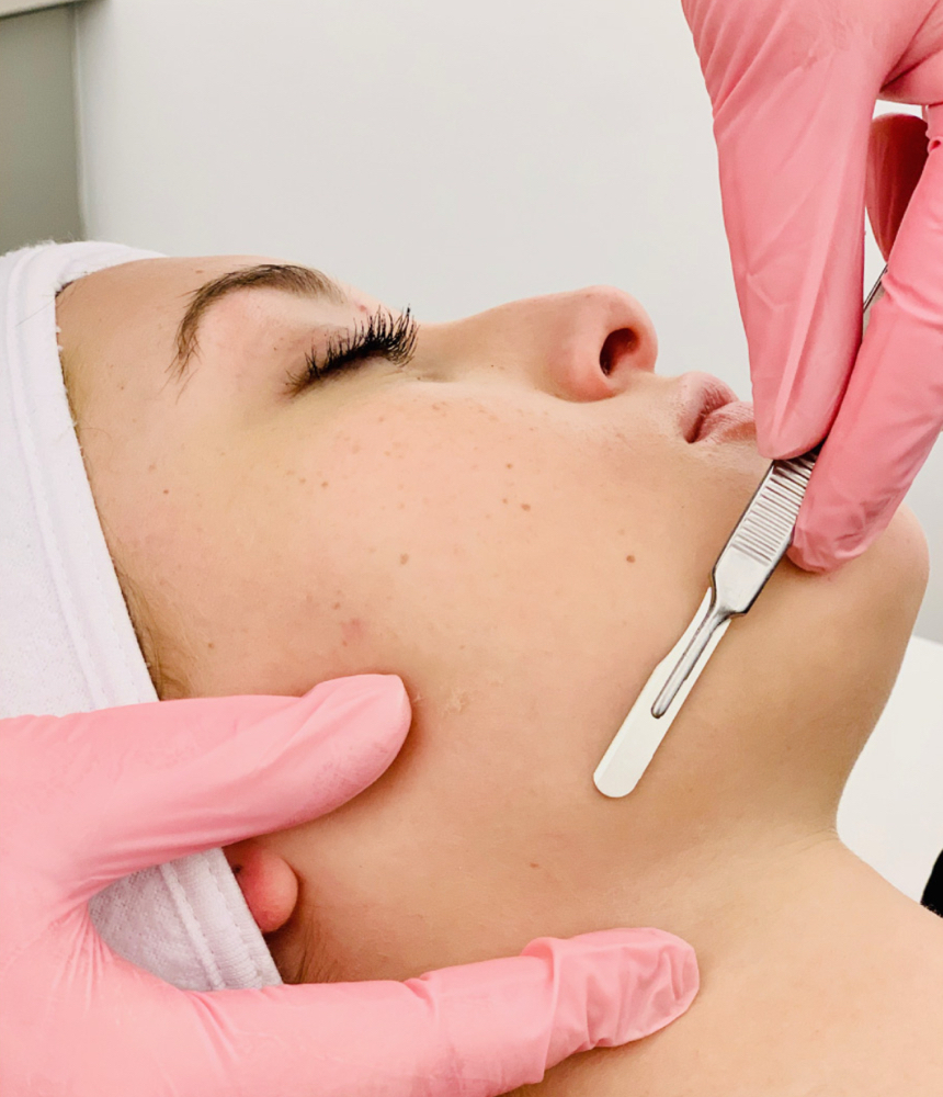 Dermaplane Facial