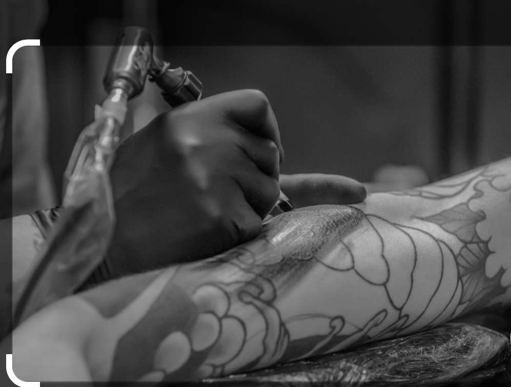 Saline Tattoo Removal