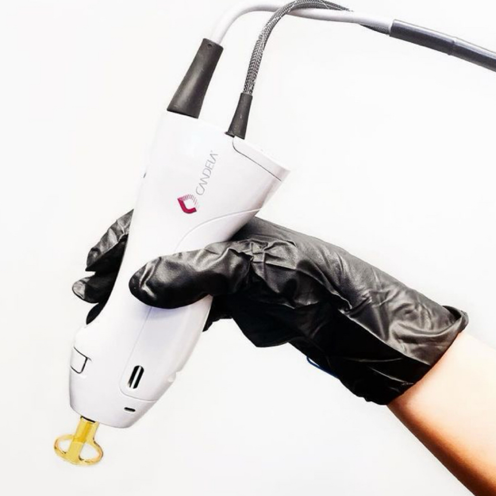 Laser Hair Removal-Upper Lip + Chin