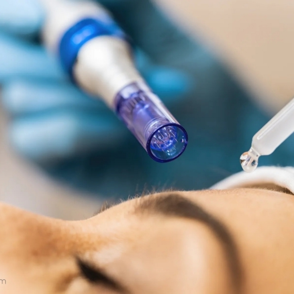 Microneedling at B3 Beauty Salon LLC in Joplin, MO