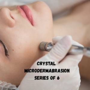 MICRODERMABRASION PACKAGE (6) at Infinite Glo Aesthetics in Sheridan, MT
