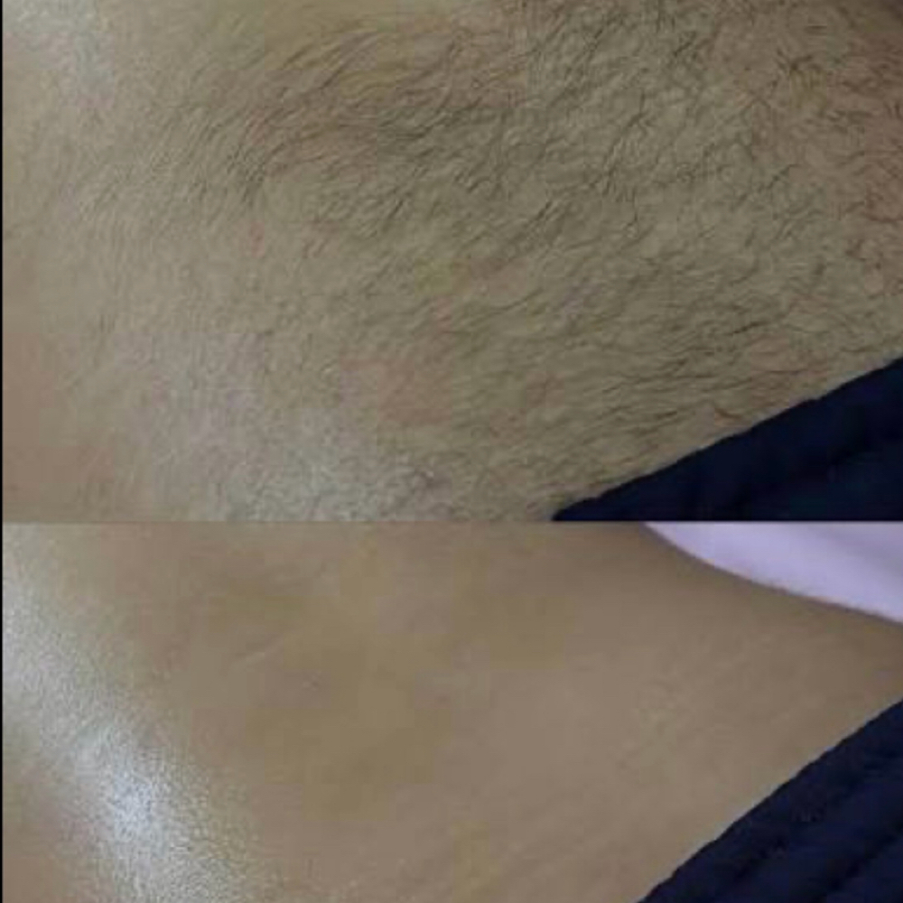 Lower Back Wax at Supple Wax & Skin in Kennesaw, GA