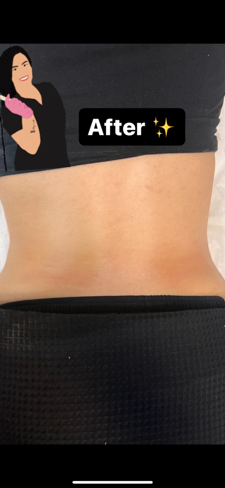 Lower Back