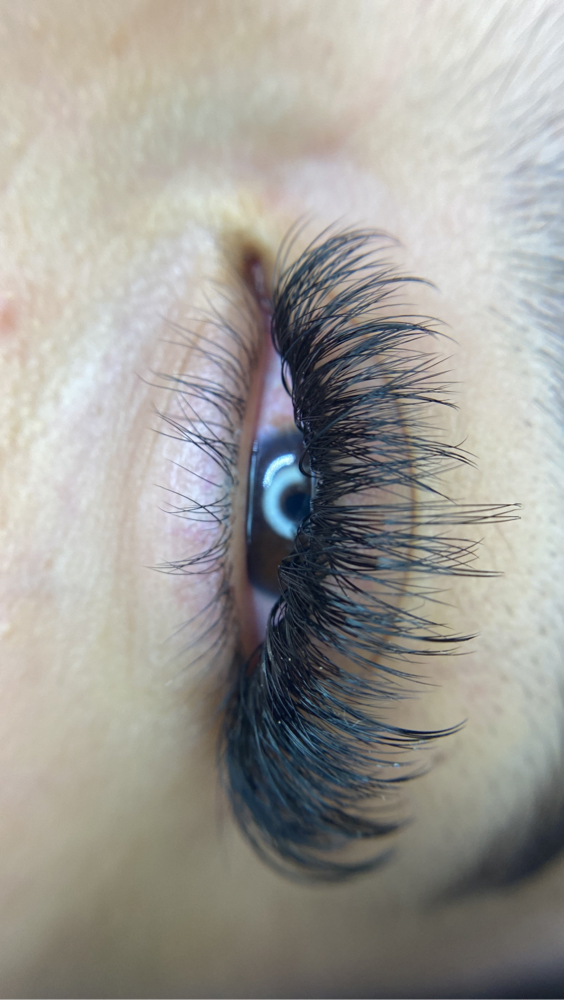 Hybrid Refill