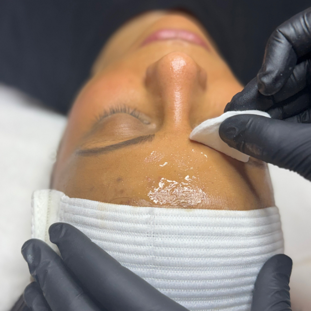 Chemical Peel 4pk at Tillie's Skincare Studio in Rockland, MA